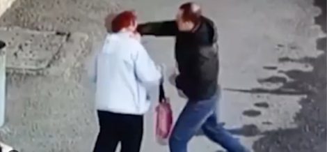 В Солигорске мужчина толкнул женщину, сломав ей руку