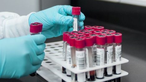 1 декабря 2025 года – День профилактики ВИЧ-инфекции